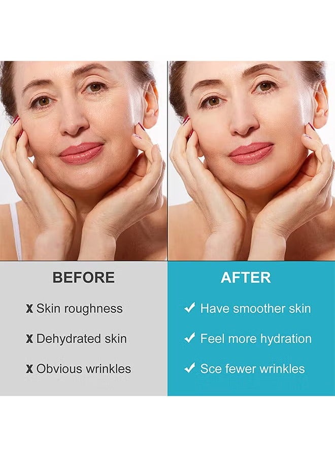 سيفودون تصحيح تسليط الوجه 160PCS, تصحيحات الجبهة Winkle, تصحيح تسليط الوجه, تصحيحات التجاعيد للوجه بين عشية وضحاها, تصحيحات الوجه للحد من التجاعيد الدقيقة, تصحيحات التجاعيد وخطوط الابتسامة - Image 5