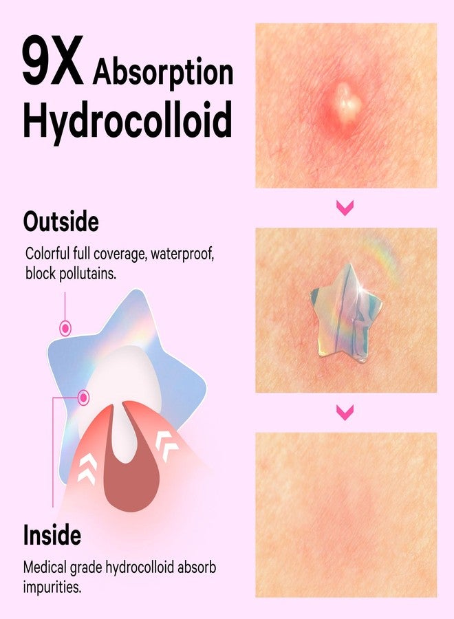 Sosky Hologram Pimple Patches for Face, Hydrocolloid Acne Patches with Salicylic Acid, Cute Star Zit Stickers,Colorful Blemish Covers,48 Count Pink Moon Flower - Image 3