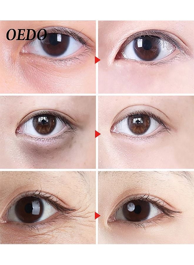 OEDO - 5 Pair Crystal Collagen Eye Mask Moist And Nourish Eyes - Image 1