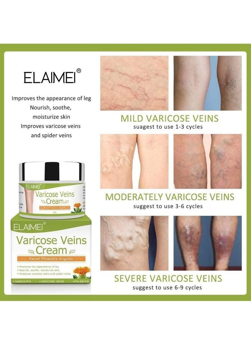Elaimei Varicose Veins Treatment Cream 50G Spider Vein Cream Relief Tired and Heavy Legs Strengthen Capillary Health Improve The Apperance of Legs  - Image 5