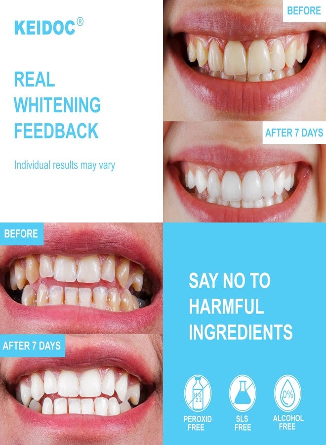 KEIDOC Teeth Whitening Strips - 14 Treatments Enamel-Safe Natural Coconut White Strips for Teeth Whitening, Non-Sensitive, Mint, 28 Strips Dry Strip - Image 2