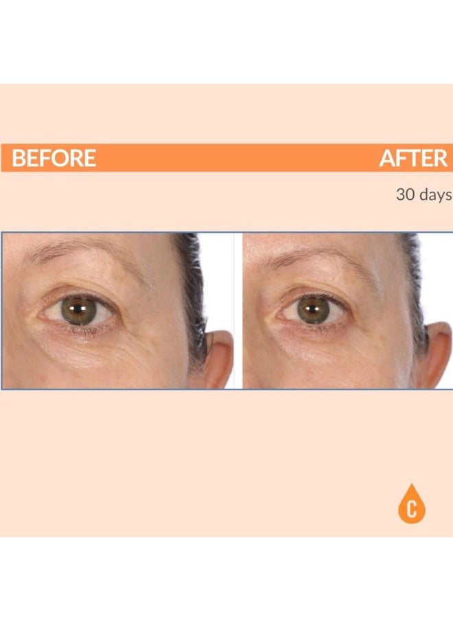 Serious Skincare Vitamin C Eye Beauty Treatment Gel - Hyaluronic Acid & Collagen - For Undereye Lines, Wrinkles, Dark Circles - Hydrating & Soothing - C3 Plasma C Ester Biotechnology 0.5 oz.  - Image 3