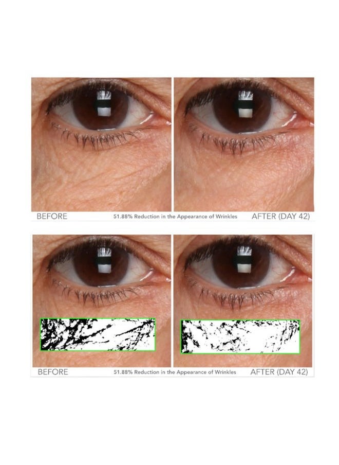 Serious Skincare Vitamin C Eye Beauty Treatment Gel - Hyaluronic Acid & Collagen - For Undereye Lines, Wrinkles, Dark Circles - Hydrating & Soothing - C3 Plasma C Ester Biotechnology 0.5 oz.  - Image 4