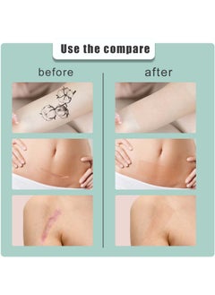 SOUTH MOON Skin Concealer Patch Patch Skin Scar Tattoo Acne Mark Cover Patch Waterproof Skin Color Invisible Patch  - Image 3
