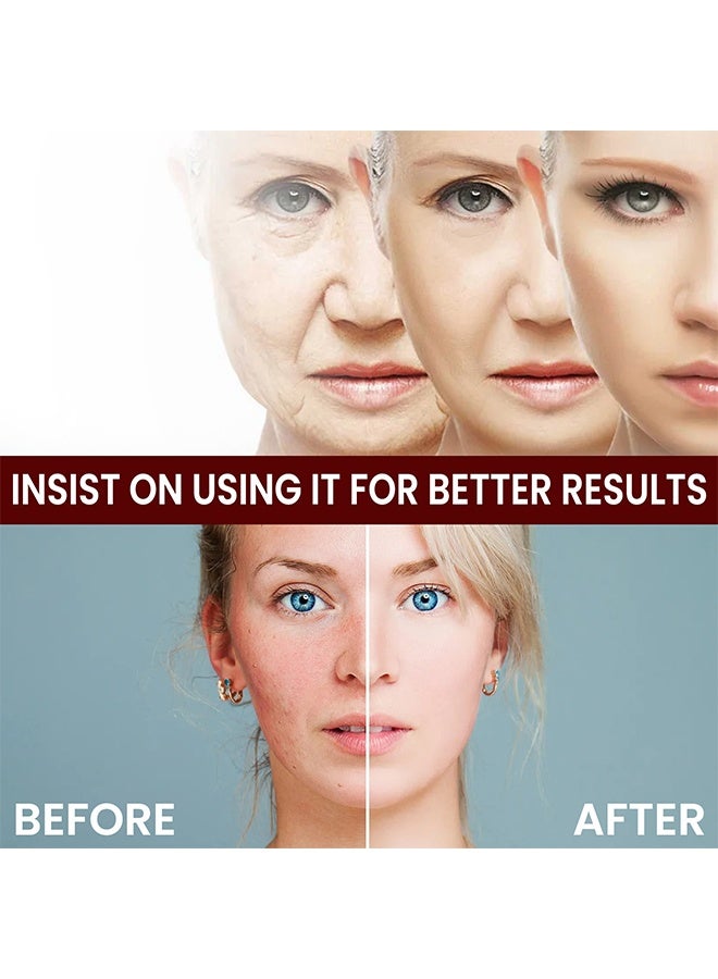 OUHOE White Rice Skin Beauty Essence ，White Rice Rejuvenating Moisturizing Face Serum. Instant Remove Wrinkles Collagen Face Cream, Smooth Face Essence For Nourishing, Tightening Pores Fine Lines 30g - Image 5
