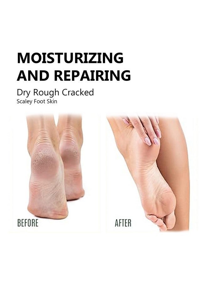 نوفال مستلزمات العناية بالقدمين كريم اليوريا 40% بالإضافة إلى حمض الساليسيليك 2%، كريم للقدمين لعلاج جفاف وتشقق الكعبين والقدمين والركبتين والكوعين واليدين - Image 4