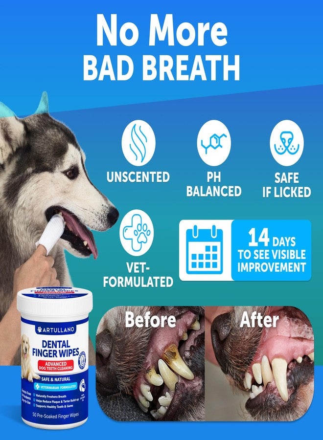 Artullano Dog Teeth Cleaning Wipes - 50 Dog Dental Care Finger Wipes - Finger Toothbrush for Removing Plaque, Tartar Buildup, Bad Breath - Oral Freshness, Healthy Teeth & Gum Support with Coconut Oil, Unscented - Image 2