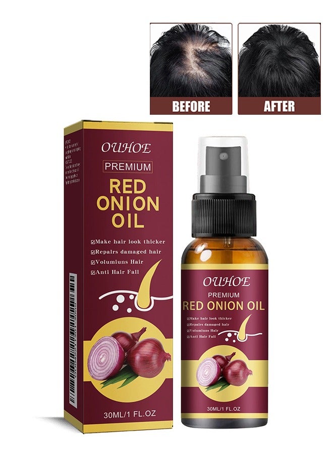 OUHOE Premium Red Onion Oil 30ml, Make Hair Look Thicker, Repalrs Damaged Hair, Volumiuns Hair, Anti Hair Fall, Hair Growth Products for Men and Women - Image 1