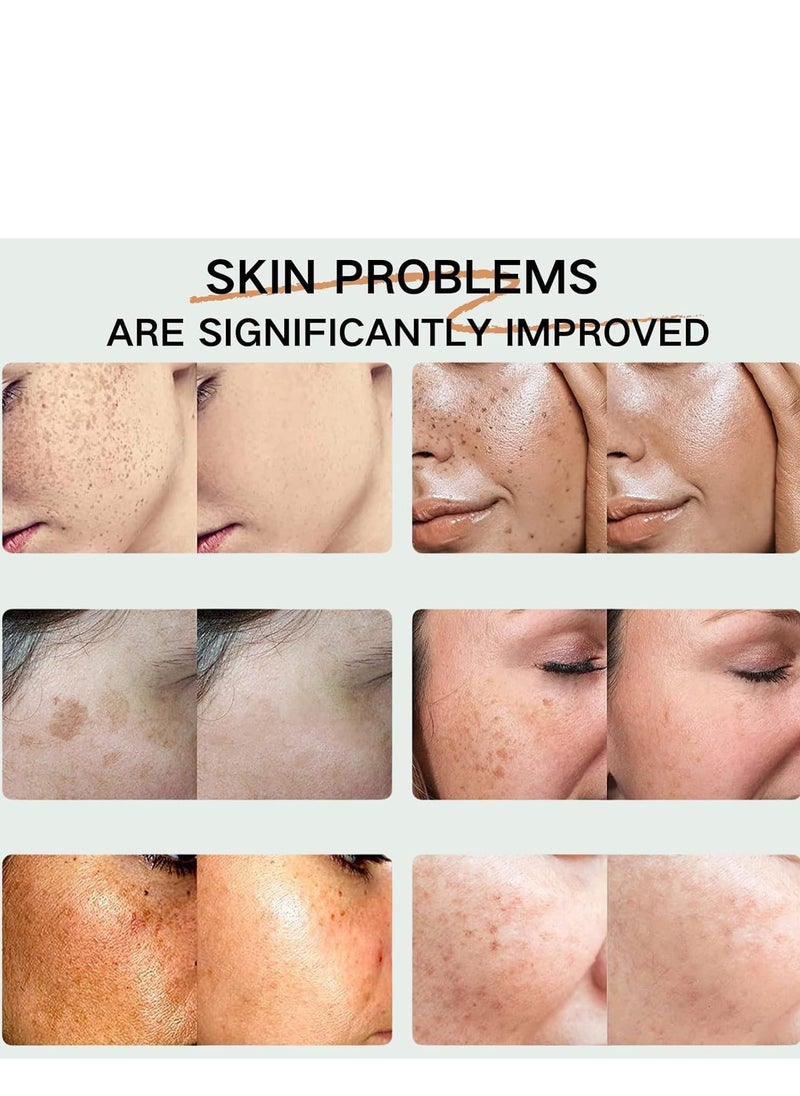 iBealee - Dark Spot Remover for Face, Dark Spot Corrector, Anti Wrinkle Face Cream, Moisturizing and Anti Blemish Spot Cream, Dark Spot Remover for Body 30g - Image 1