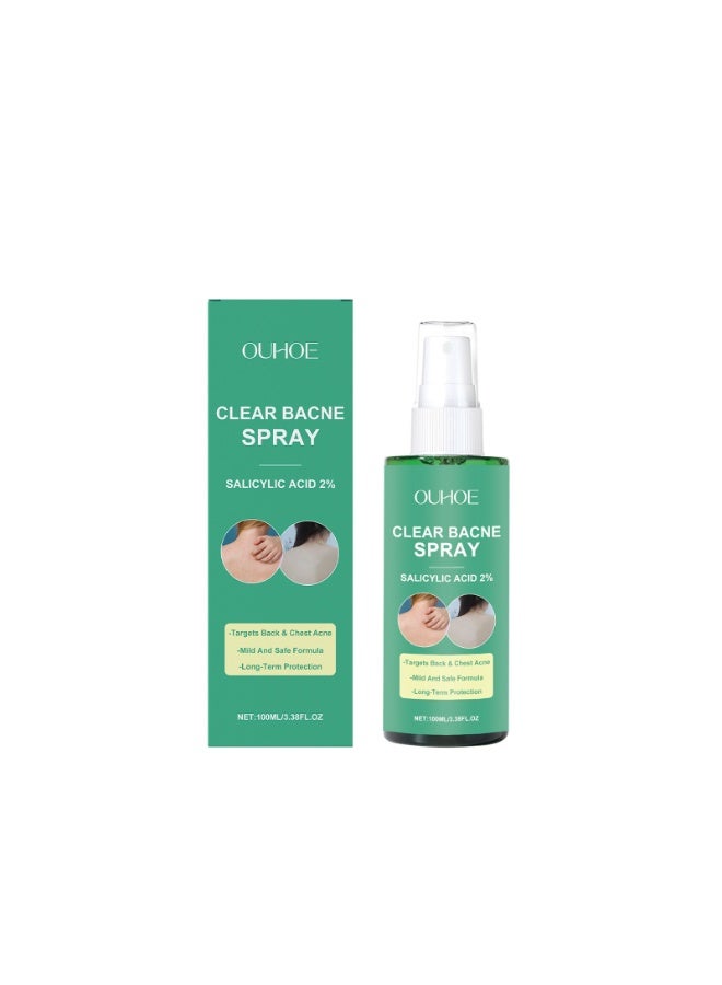 OUHOE Bacne Spray for Back Acne – Salicylic Acid & Witch Hazel Formula – Soothes & Hydrates – Fast-Acting, Non-Irritating, Safe for Teens & Adults – For All Skin Types - Image 1