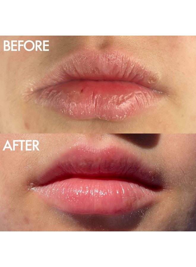 لانو ليبس مرهم لانوليبس ١٠١ - مرطب شفاه باللانولين لشفاه ناعمة ورطبة وصحية - مرهم شفاه متعدد الاستخدامات بزيت اللانولين للشفاه الجافة والبشرة المحيطة بالأظافر وغيرها - بنكهة الفراولة (٠٫٥٢ أونصة) - Image 2