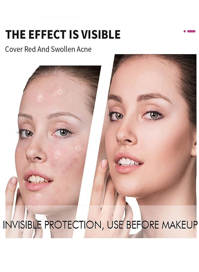 RtopR 24 Patches Acne Pimple Patch Healing Acne And Pustule Can Be Used Day And Night - Image 5