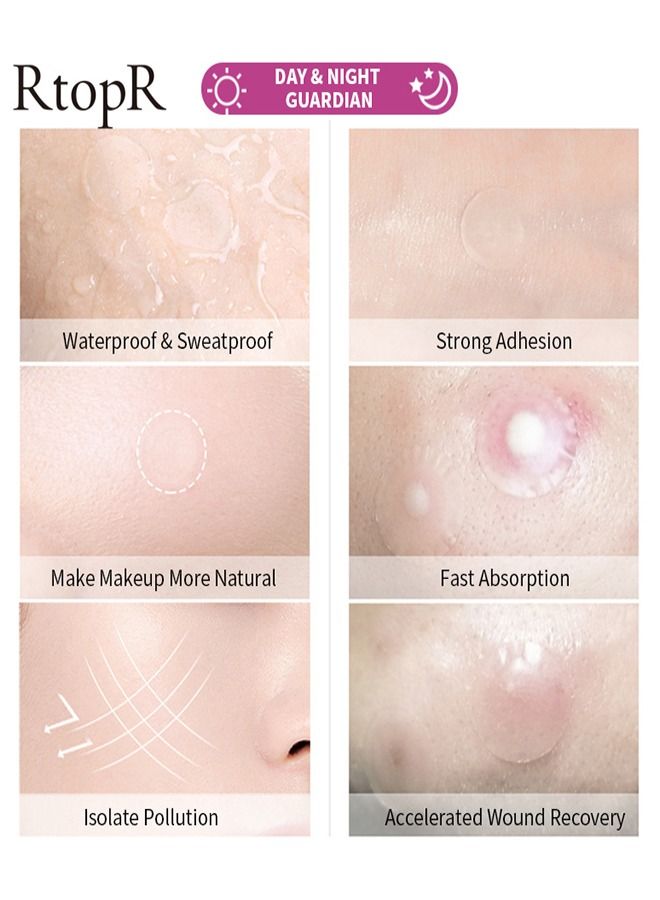 RtopR 24 Patches Acne Pimple Patch Healing Acne And Pustule Can Be Used Day And Night - Image 4