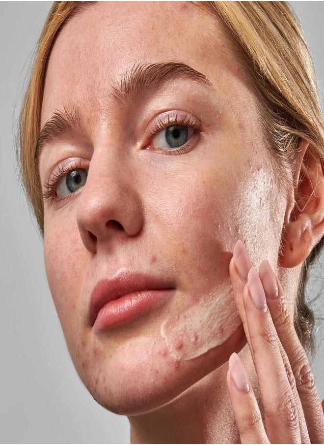 The Inkey List - The Inkey List Blemish Clearing Moisturizer - 2% NovoRetin 50ml - Image 1
