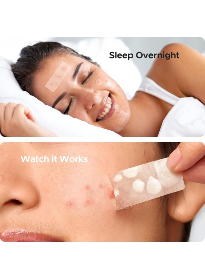 اكني باتش 302 قطعة من رقعة البثور الكبيرة للوجه، 7 أحجام من رقعة حب الشباب، رقعة هيدروكولويد كبيرة للجسم والذقن والجبهة والصدر والظهر، تخفف من ظهور حب الشباب والرؤوس السوداء، خفيفة وغير مزعجة - Image 2