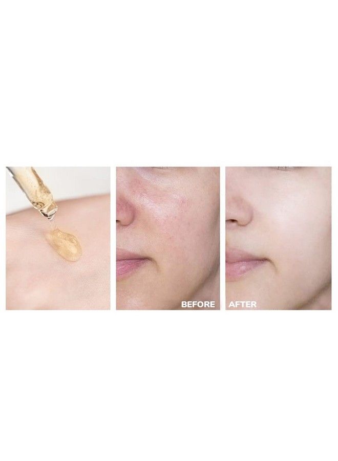 MOND'SUB سيروم فيتامين سي المشرق المرفع للوجه مع (3O حمض الأسكوربيك الإيثيلي) لتفتيح وتقليل التجاعيد ورفع مرونة البشرة وتلاشي فرط التصبغ وتوحيد لون البشرة 30 مل - Image 5