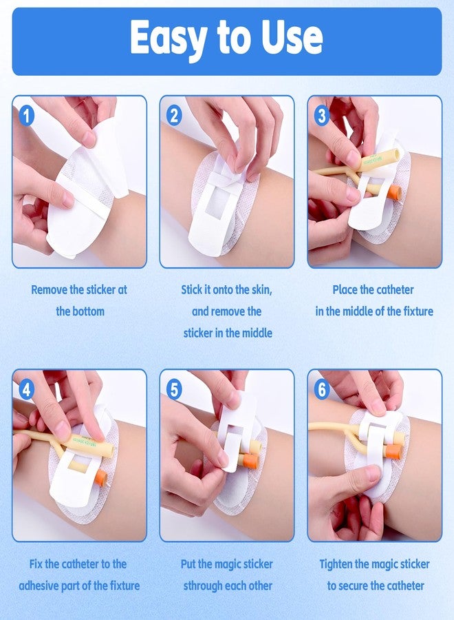 BeHerk 12 PCS Catheter Stabilization Devices, Foley Catheter Supplies, Urinary Leg Bag Legband Holder Sticker, Self Adhesive Catheter Tube Holder for PEG/G/Feeding Tube（White） - Image 5