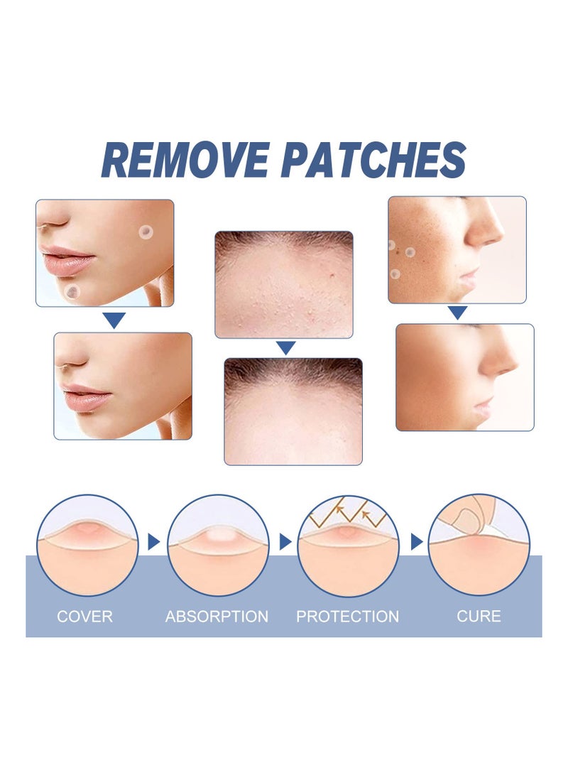 Generic Skin Tag Removal Kit - 144 Pcs Fast & Easy Home Tool for Removing Flesh and Black Nevus, Safe & Painless Lightening Agent Patches for Effective Skin Treatment. - Image 4