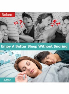 HY Nose Vent Sinus Relief Dilator (Pack of 8 Various Sizes), Anti Stopper, Snore Reducing Advanced Devices Aids, Reusable Snoring Device to Enjoy a Peaceful Night's Sleep  - Image 2
