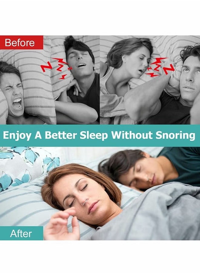 HY - Nose Vent Sinus Relief Dilator (Pack of 8 Various Sizes), Anti Stopper, Snore Reducing Advanced Devices Aids, Reusable Snoring Device to Enjoy a Peaceful Night's Sleep - Image 1