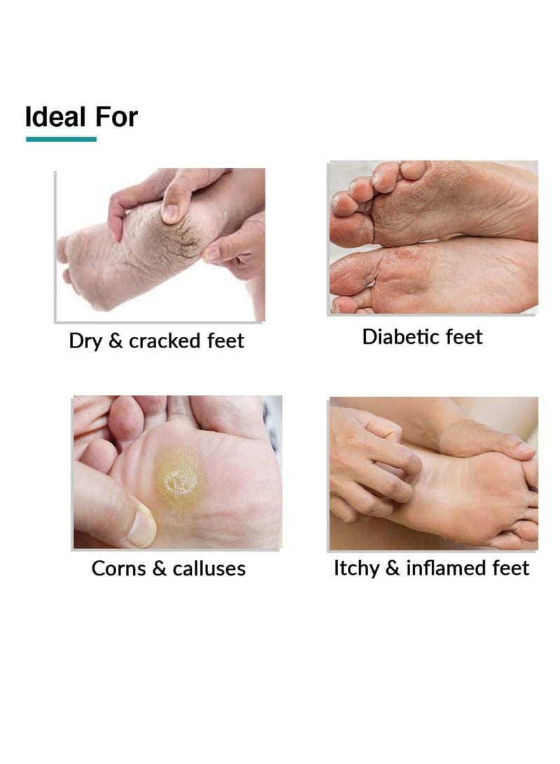 فيكسديرما كريم فوبيتيك، كريم للقدم، للعناية بالقدم، للأقدام الجافة والمتشققة، يرطب ويلطف القدم، إصلاح الكعب، للبشرة المتصلبة أو المتشققة، خالي من البارابين 100 جم - Image 4