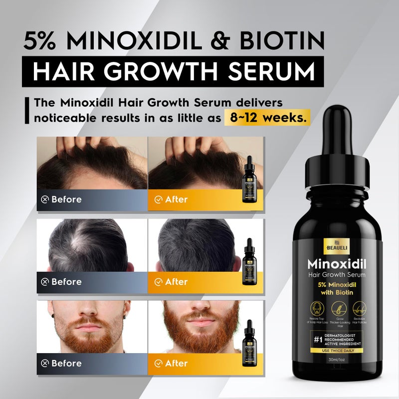 beaueli 5% Minoxidil Hair Growth for Men and Women: Extra Strength Minoxidil Regrowth Treatment Serum for Thinning Hair Loss to Grow Thicker Fuller Faster 30ml 3Bottles - Image 2