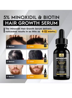 beaueli 5% Minoxidil for Men Hair, Minoxidil for Women Hair Growth, Hair Growth Oil, Extra Strength Minoxidil Hair Loss Treatment Serum for Faster Stronger Thicker Hair Growth 1oz, 3 Bottles  - Image 2