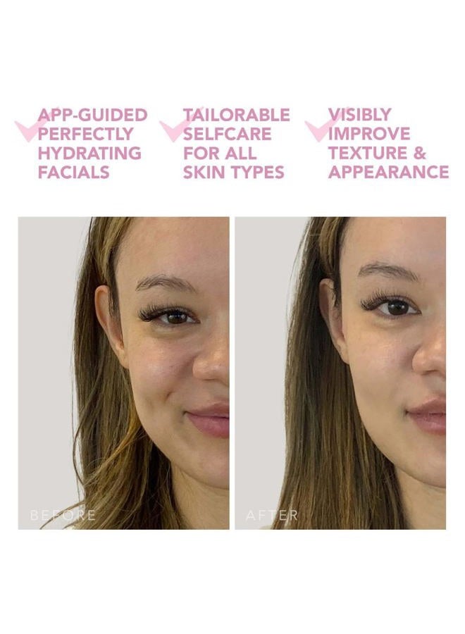 FOREO علاج قناع الوجه UFO ميني 2 - علاج الضوء الأحمر للوجه - تدفئة - مرطب للوجه - علاج للبقع الداكنة وآثار حب الشباب للوجه - مغذي - وردي لؤلؤي - Image 5