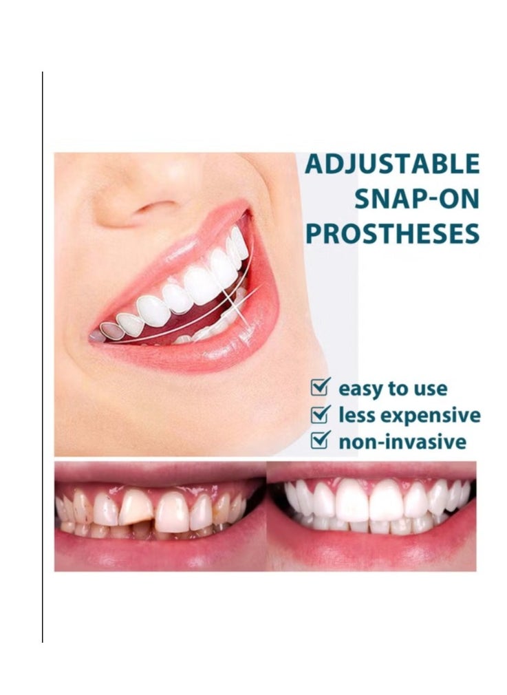 EELHOE Adjustable Snap-on Prostheses dentures, upper and lower jaw cosmetic denture veneers, smile temporary dental restoration kit  - Image 3