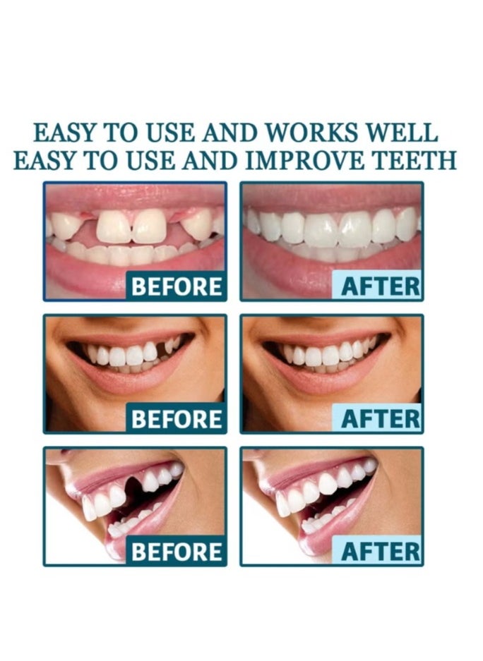 EELHOE Adjustable Snap-on Prostheses dentures, upper and lower jaw cosmetic denture veneers, smile temporary dental restoration kit  - Image 5