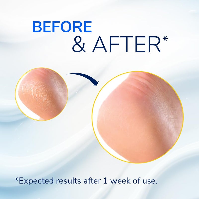 Dr. Scholl's بلسم إصلاح كعب القدم المتشقق الشديد من د. شول 2.5 أونصة، مع 25% يوريا للقدمين الجافتين والمتشققين، يعالج ويرطب من أجل أقدام صحية - Image 3
