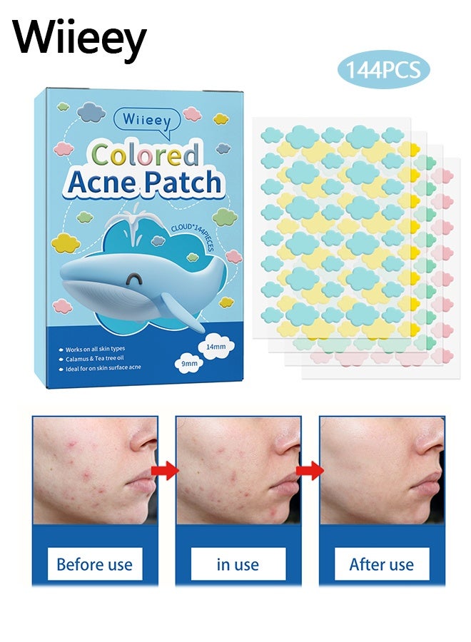 wiieey 144Pcs Pimple Patches for Face,Hydrocolloid Acne Patches for Covering Zits and Blemishes, Cute Spot Stickers for Skin Care - Image 1