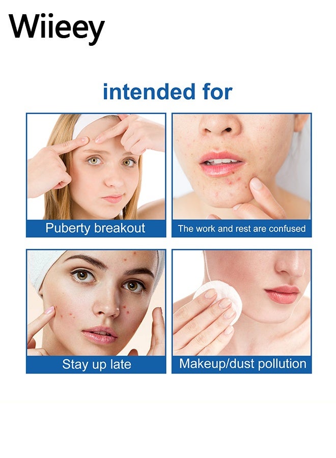 wiieey 144Pcs Pimple Patches for Face,Hydrocolloid Acne Patches for Covering Zits and Blemishes, Cute Spot Stickers for Skin Care - Image 4