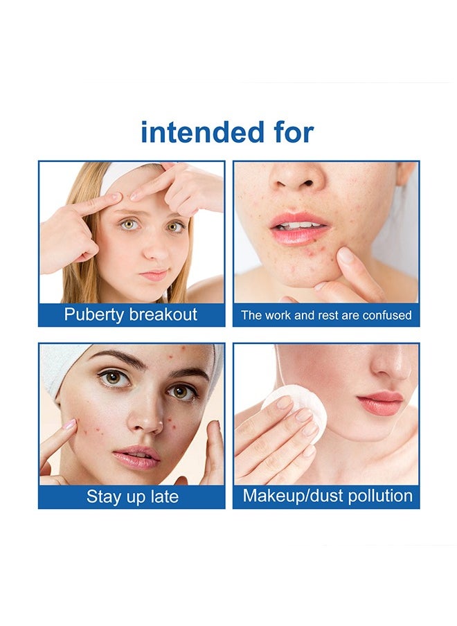 wiieey 144Pcs Pimple Patches for Face,Hydrocolloid Acne Patches for Covering Zits and Blemishes, Cute Spot Stickers for Skin Care  - Image 5