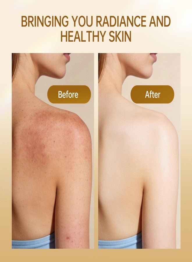 BOLI Turmeric Body Scrub with Kojic Acid, Remove Dead Skin, 10.58 oz - Image 5