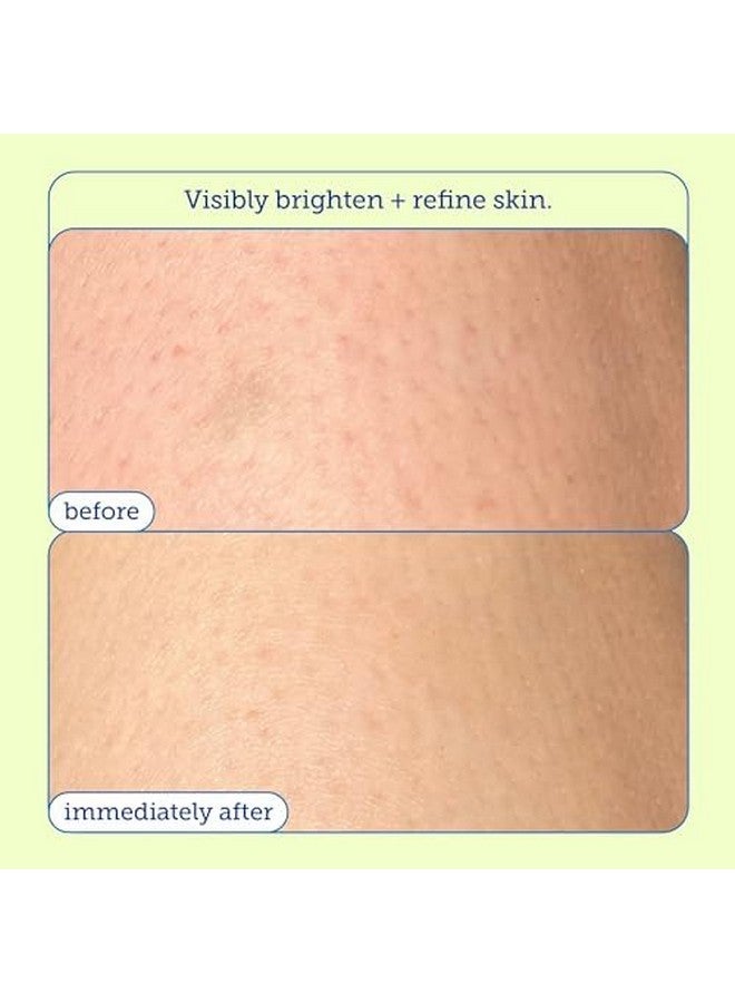 Skinfix Skinfix Resurface+ Glycolic Renewing Scrub: A Double-Duty AHA BHA Exfoliant Scrub & Body Peel to Visibly Polish, Refine, Brighten & Smooth Rough, Bumpy & Crepey Skin Caused KP-Prone Skin, 8 Fl Oz  - Image 4