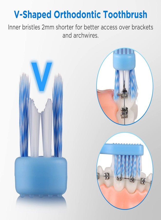 Fremouth V-Shaped Orthodontic Toothbrush for Braces, Soft Bristles, 6 Count, with Interdental Brushes - Image 2