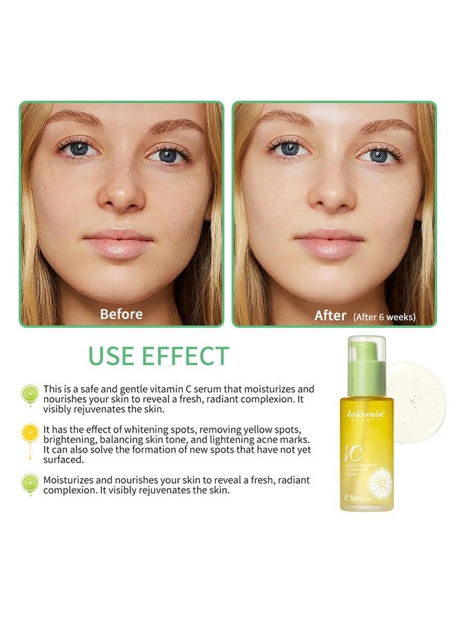 NICEFACE Green Tangerine Vitamin C Face Serum Facial Serum With Vitamin C Niacinamide & More Brightening Serum For Dark Spots Balancing Skin Tone And Lightening Acne Marks (50Ml) - Image 5