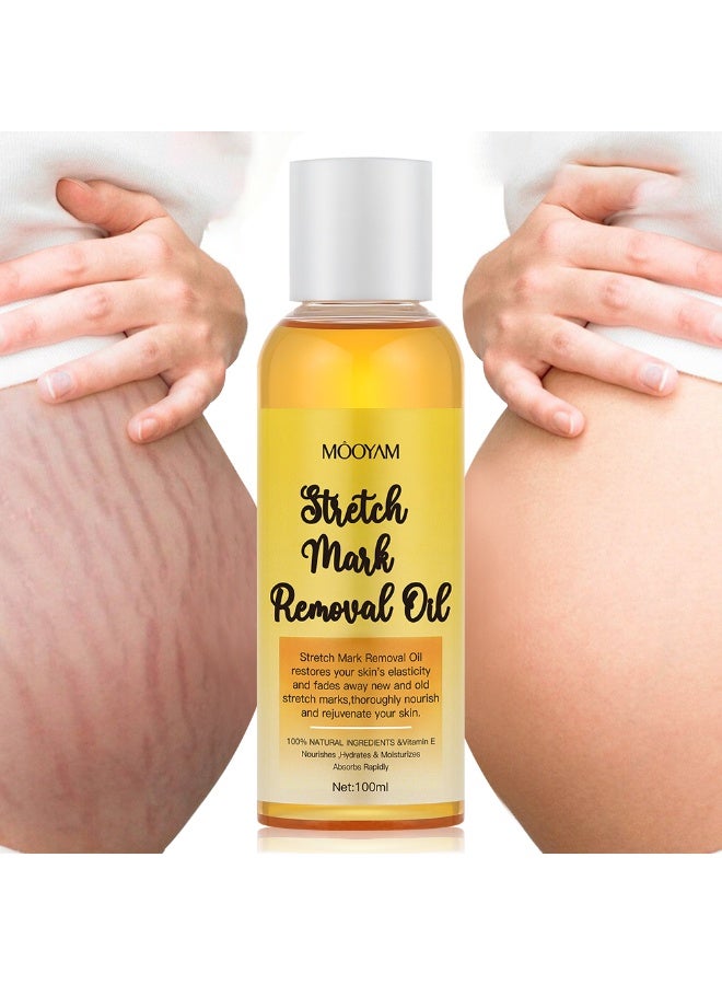 MOOYAM Stretch Mark Removal Oil with Vitamin E for Fading New Old Marks Improves Skin Elasticity Fast Absorbing Hydrating Body Treatment for Pregnancy and Weight Loss 100ml - Image 1