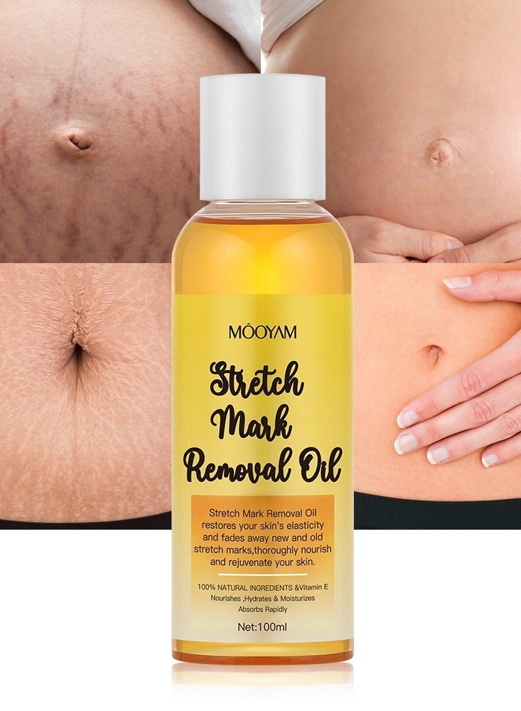 MOOYAM Stretch Mark Removal Oil with Vitamin E for Fading New Old Marks Improves Skin Elasticity Fast Absorbing Hydrating Body Treatment for Pregnancy and Weight Loss 100ml - Image 1