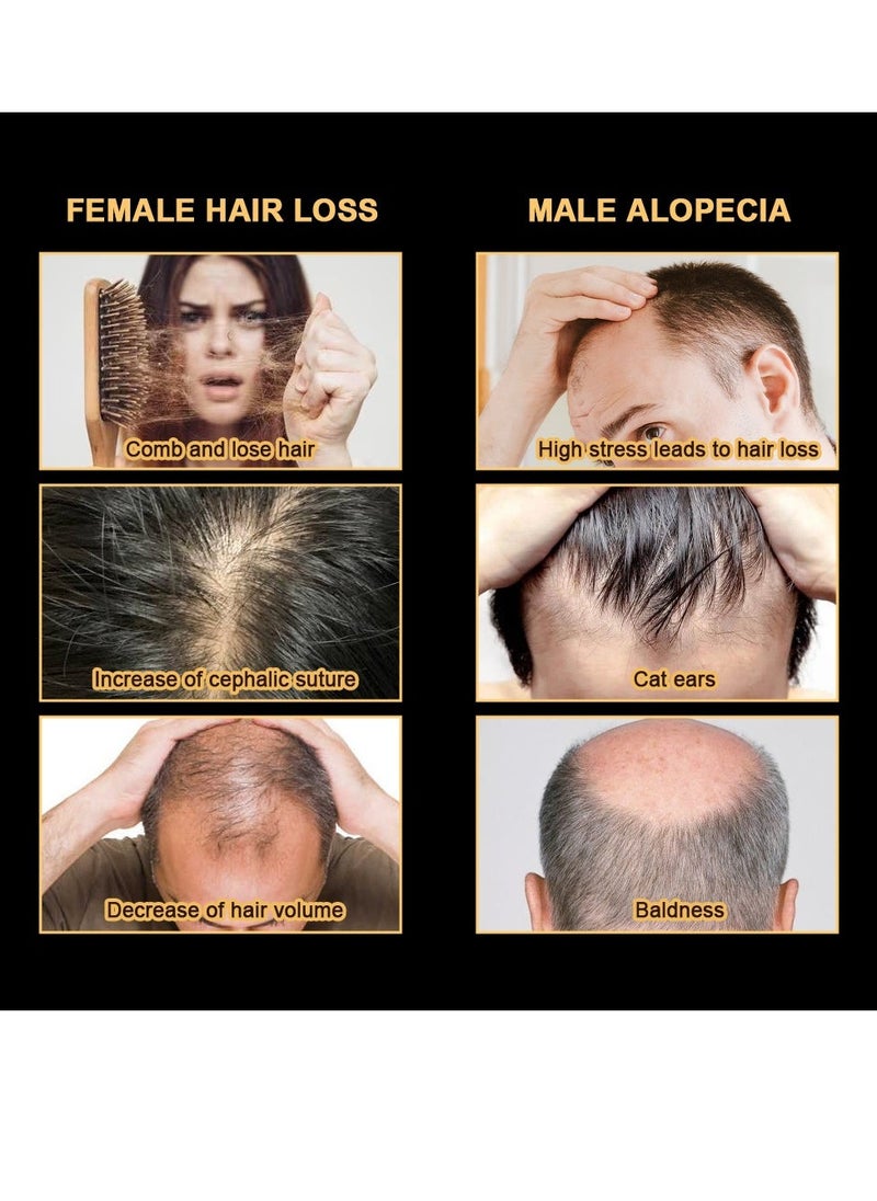 Sumifun Hair Repair Lotion Alopecia Promotes Healthy Hairï¼Suitable for both men and women 30ml - Image 2