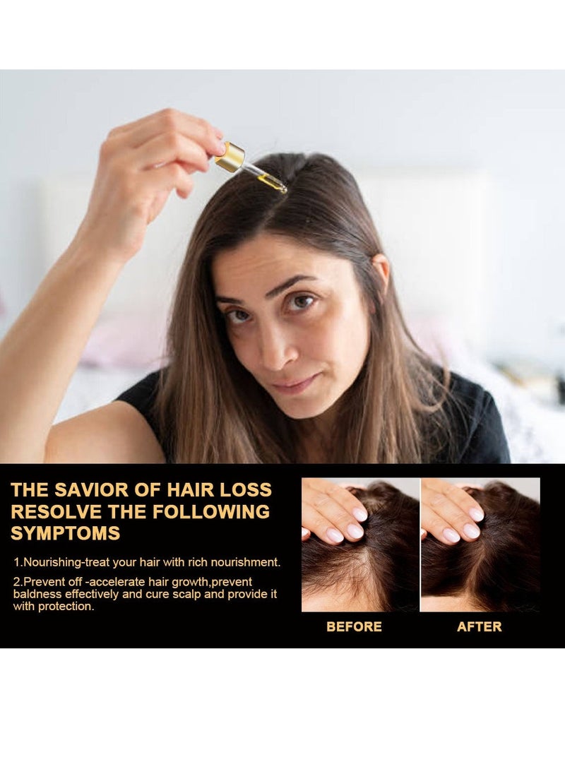 Sumifun Hair Repair Lotion Alopecia Promotes Healthy Hairï¼Suitable for both men and women 30ml - Image 4