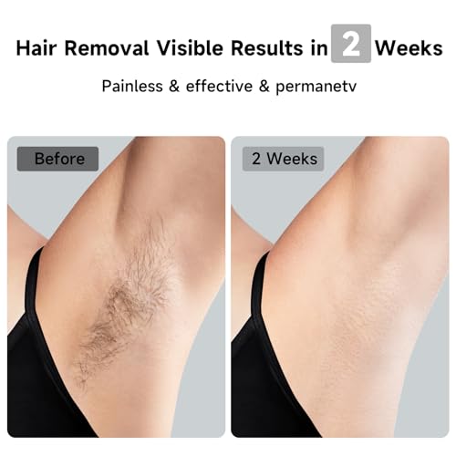 JOVS Laser Hair Removal, 37°F Painless Hair Removal Device with Sapphire Ice-Cooling, 3 in 1 Hair Removal & Skin Rejuvenation for Women and Men, 8 Modes Skin Care for Whole Body, Touch Screen, White - Image 4