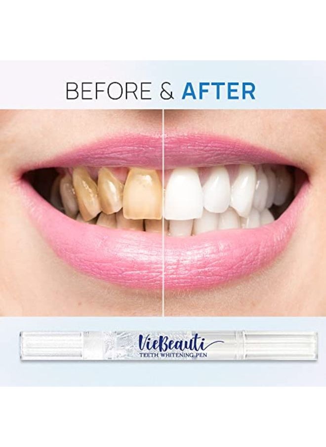 VieBeauti - Teeth Whitening Pen(2 Pcs), 20+ Uses, Effective, Painless, No Sensitivity, Travel-Friendly, Easy To Use, Beautiful White Smile, Natural Mint Flavor - Image 1
