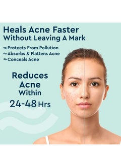 GUBB Acne Pimple Patches Invisible Facial Stickers Cover With 100% Hydrocolloid Pimple Patches For Face Acne Patches For Face (36 Pieces)  - Image 5