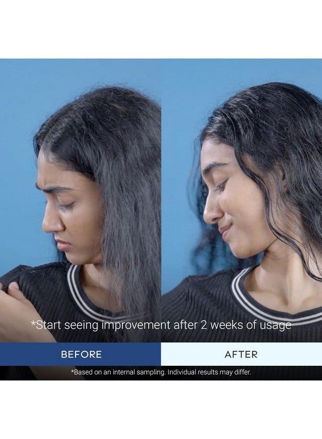 ARATA Anti Dandruff Shampoo | Dandruff Remover With Piroctone Olamine, Cutibiome Clr™, Neem | Reduces Flaking And Scalp Irritation | Anti Dandruff Shampoo For Men & Women | For All Hair Types | 200Ml - Image 5