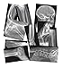 Roylco Broken Bones XRays  15 Piece Real Human Fracture XRay Set with Teaching Guide for STEMSTEAM Anatomy Biology Light Table  Classroom Science Learning - Image 4