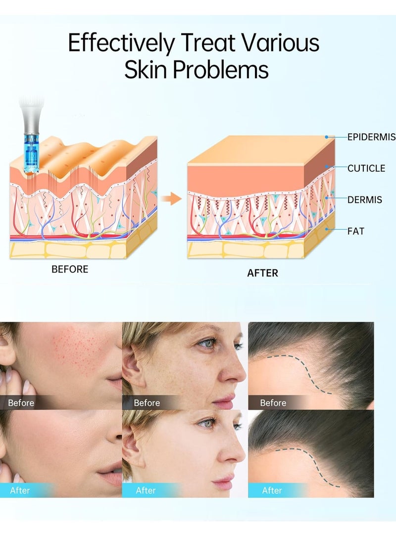 Dr.pen Dr. Pen M8S Microneedling Wireless Micro Needling Devices Skin Care Tool Kit for Anti-aging Acne Scars Wrinkles with 10 pcs  - Image 5