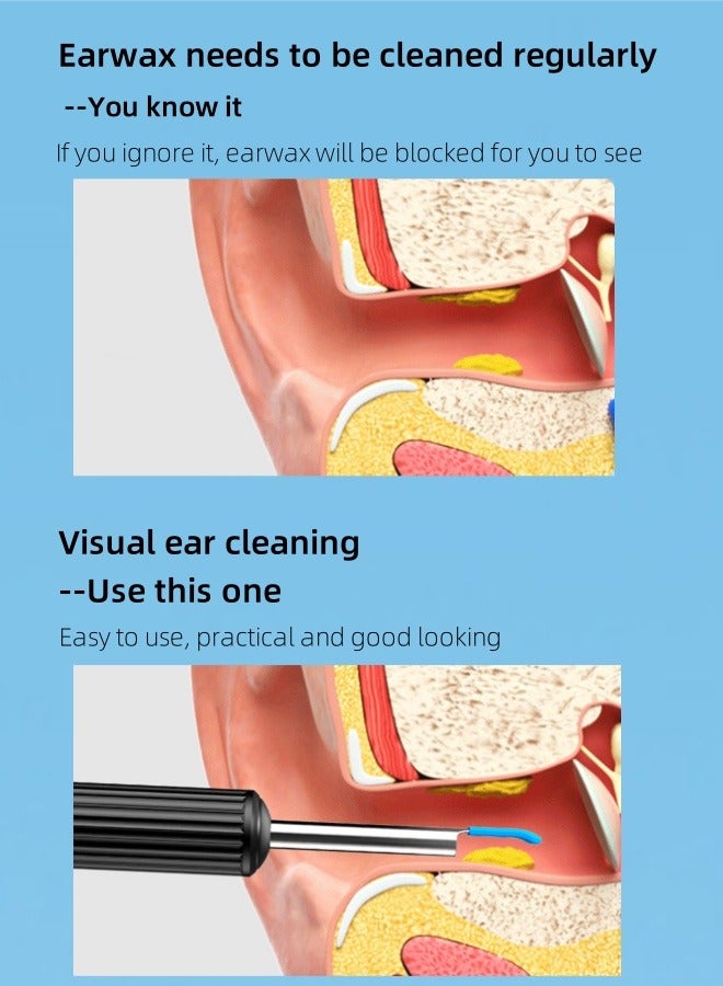 Generic Earwax removal kit - visual ear pick with camera, equipped with stainless steel ear cleaner, ear cleaner with 8 ear picks + 6 silicone ear picks, otoscope with LED light, mobile phone wireless connection visual otoscope earwax  - Image 2