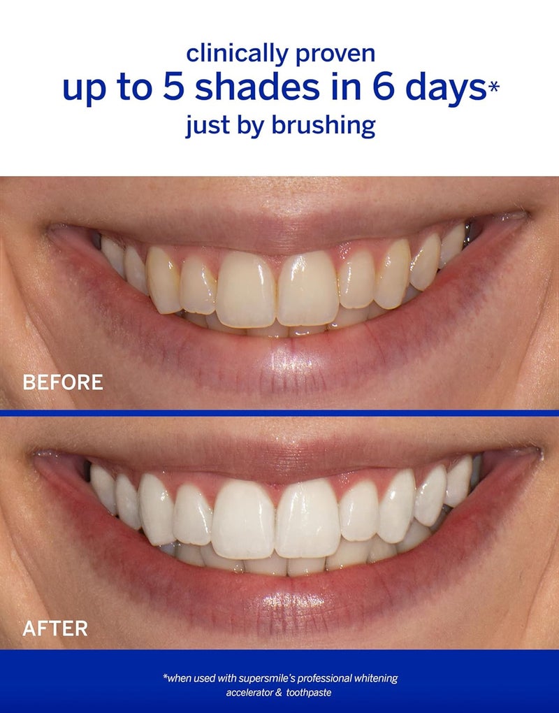 Supersmile Professional Whitening Accelerator - Powerful Whitening Without Sensitivity - Safe and Effective on Dental Restorations (8 oz) - Image 3